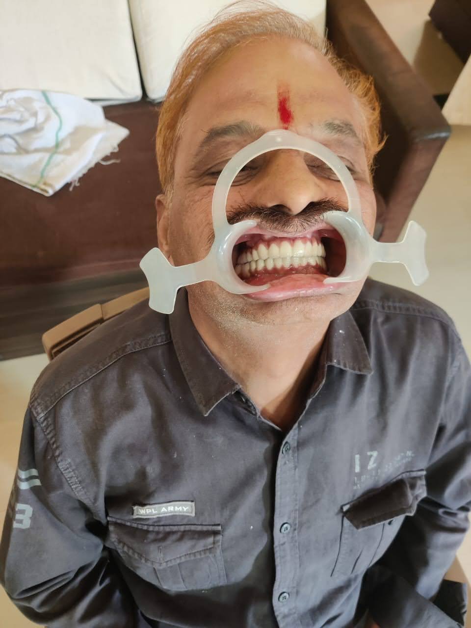 Murlidhar Visave after fixed-smile treatment