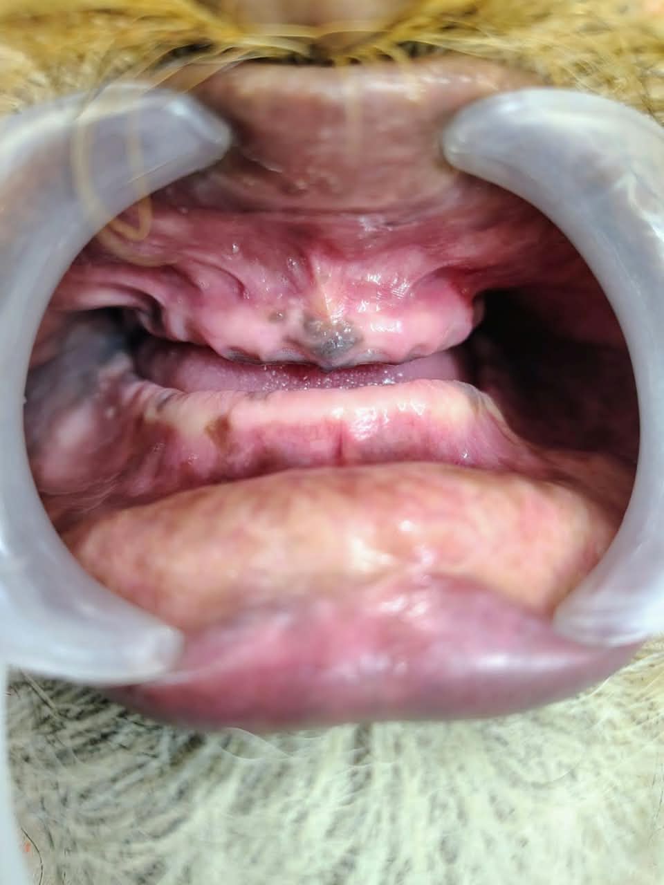Chandangiri Maharaj · Bhandara Dongar, Dehu, Pune before fixed-smile treatment