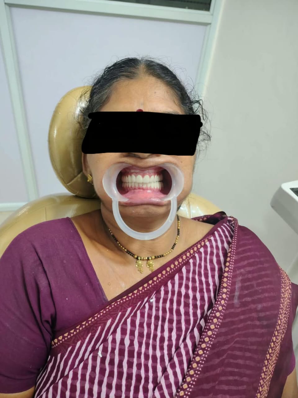 Mrs Mane after fixed-smile treatment