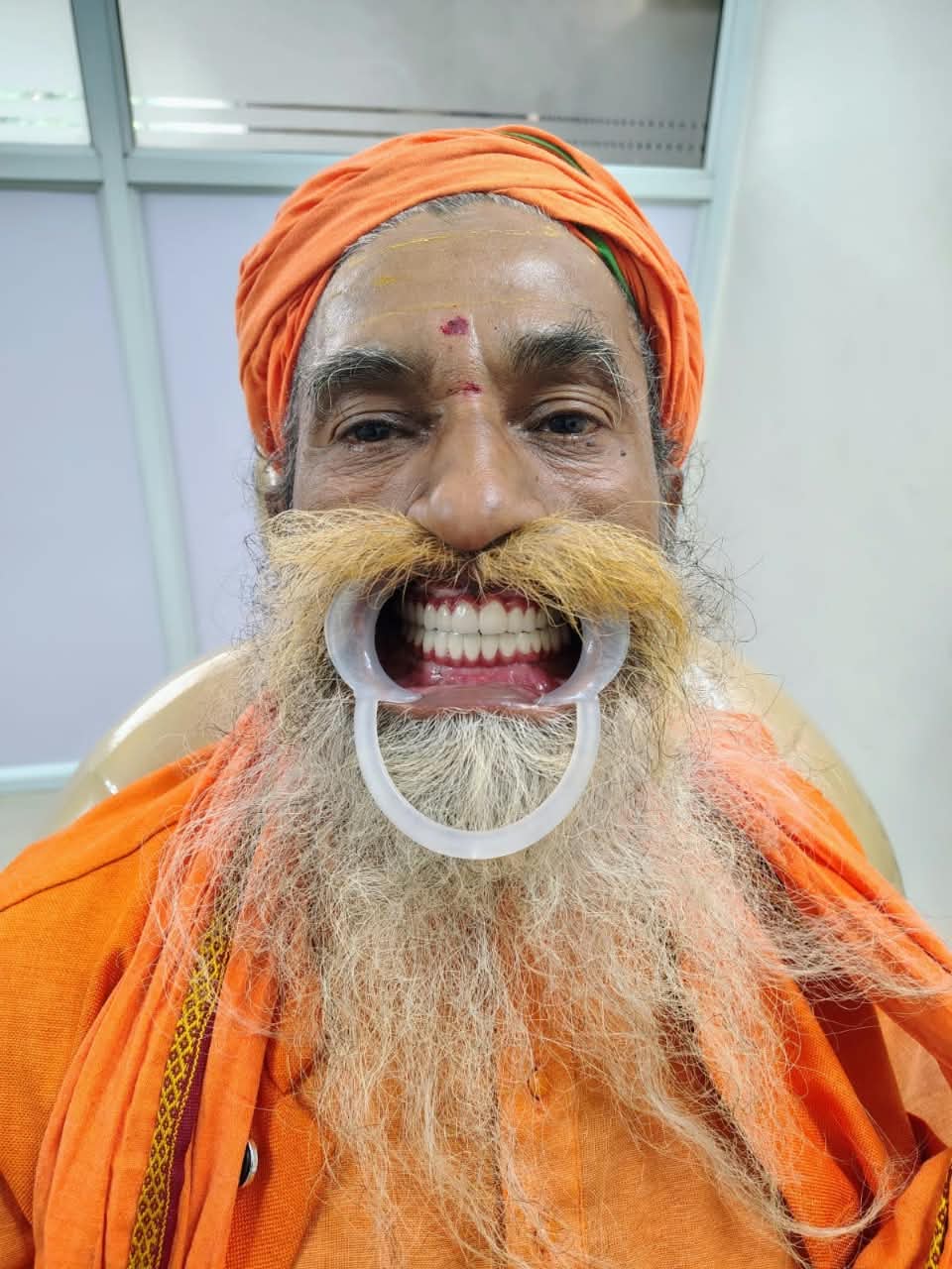 Chandangiri Maharaj after fixed-smile treatment