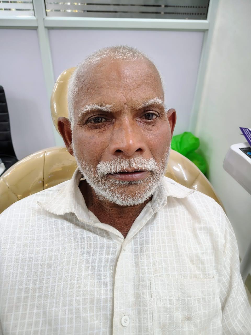 Mr Uttam Hagavane · Dehu, Pune before fixed-smile treatment
